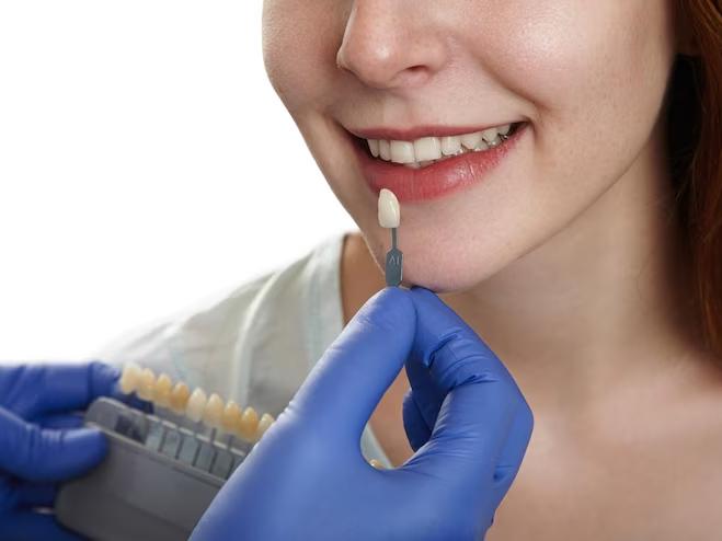 patient's teeth