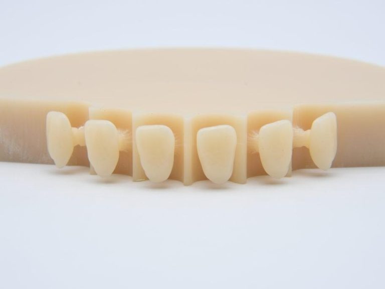 Enhance Your Smile with PMMA Dentures A Comprehensive Guide