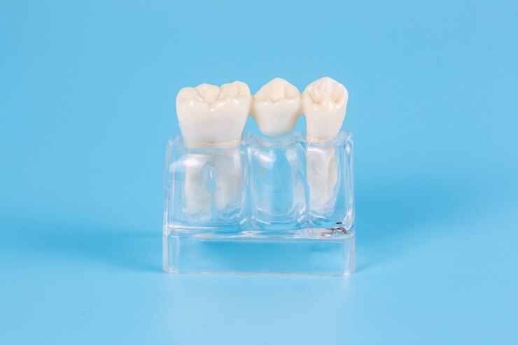 XANGTECH's Lithium Disilicate vs