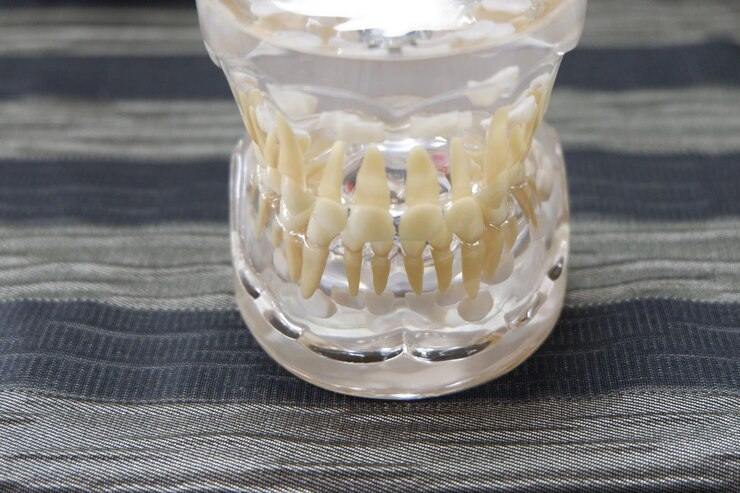 The Strength and Transparency of Lithium Disilicate Blocks in Dental Work