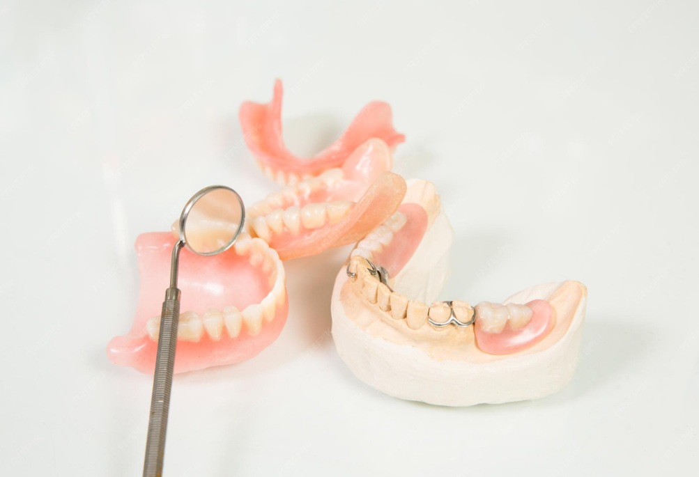 Why Multilayer PMMA Block is Essential for Long-Term Temporary Restorations