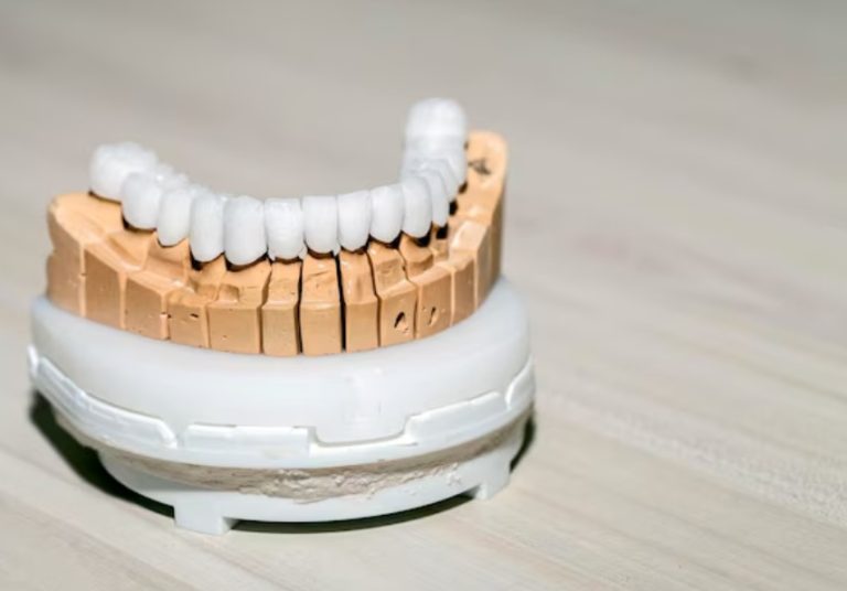 Why Dental Professionals Prefer Lithium Disilicate Crowns for Aesthetics